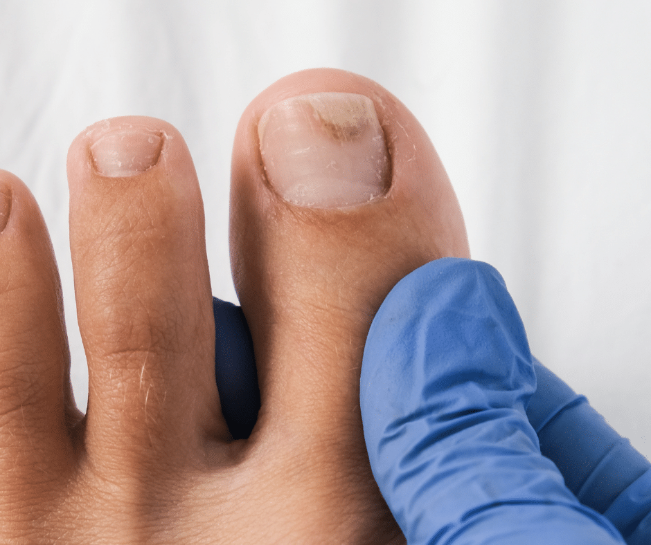 what-is-difference-between-podiatrist-and-podologist-northwich