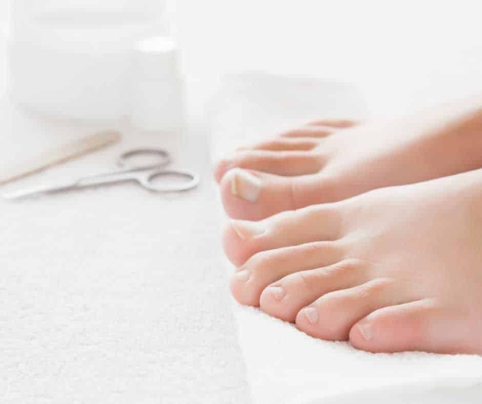 What To Expect After Nail Removal Surgery | Northwich Foot Clinic