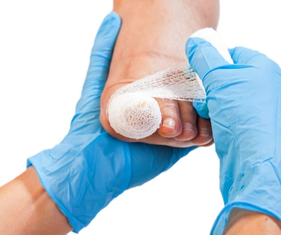 Why You Need Nail Surgery And What To Expect From Treatment